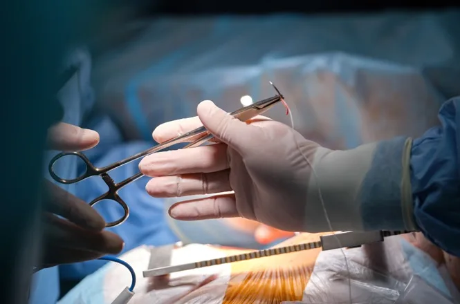 Médico é condenado a pagar R$ 10 mil por dano moral após paciente encontrar corpo estranho no abdômen