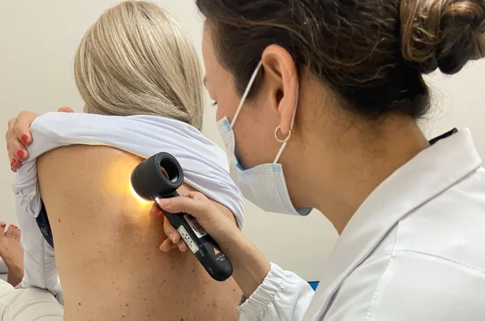 Santa Catarina reforça alerta para prevenção do melanoma